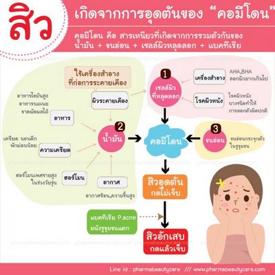 การรักษาสิว Vulgaris - วิธีที่ดีที่สุด